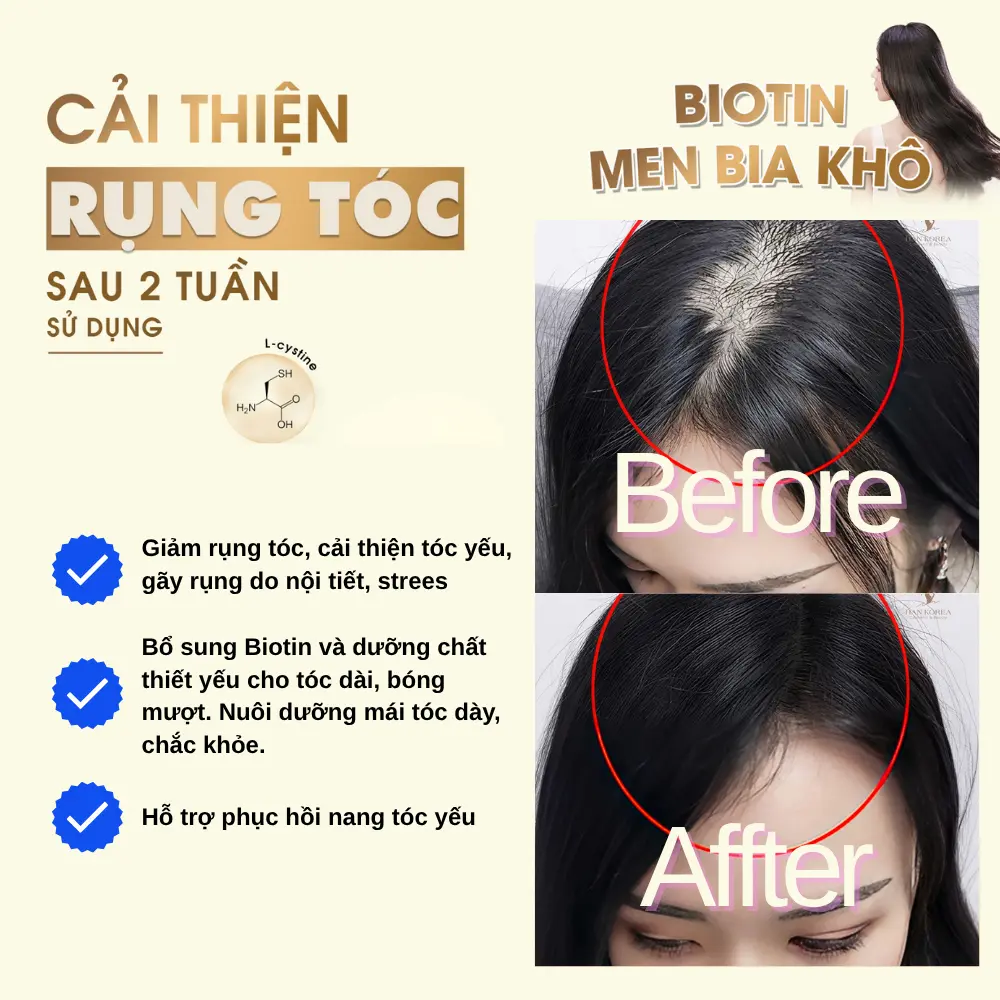 Viên Uống Mọc Tóc Biotin - Men Bia Khô